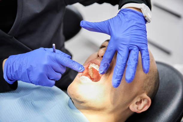Best Emergency Dentist for Lost Fillings or Crowns in Madras, OR